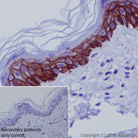 Immunohistochemistry (Formalin/PFA-fixed paraffin-embedded sections) - Anti-Aquaporin 3 antibody [EPR19932] (AB215853), expandable thumbnail