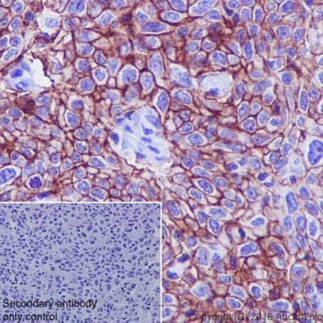 Immunohistochemistry (Formalin/PFA-fixed paraffin-embedded sections) - Anti-Aquaporin 3 antibody [EPR19932] (AB215853), expandable thumbnail
