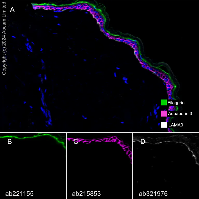 Multiplex immunohistochemistry - Anti-Aquaporin 3 antibody [EPR19932] (AB215853)