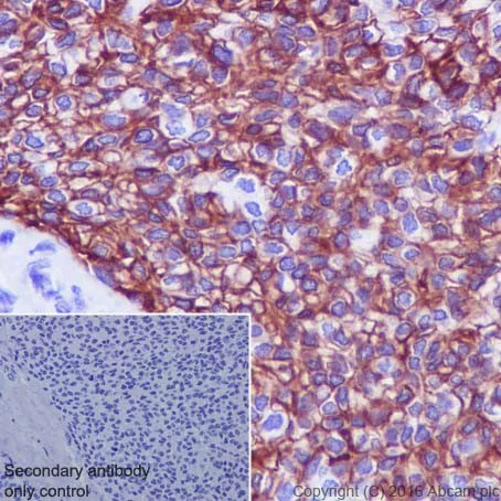 Immunohistochemistry (Formalin/PFA-fixed paraffin-embedded sections) - Anti-Aquaporin 3 antibody [EPR19932] - BSA and Azide free (AB240393)