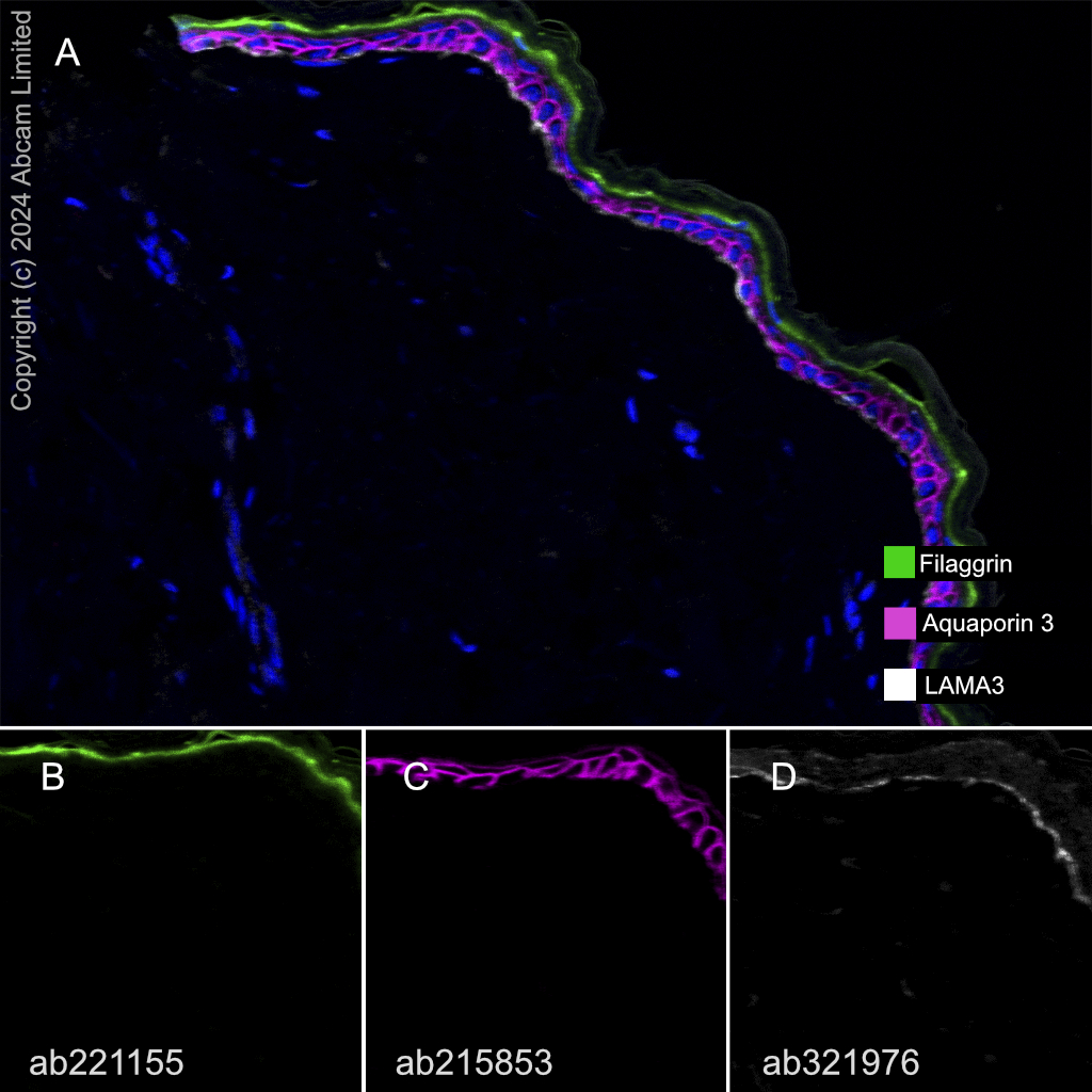 Multiplex immunohistochemistry - Anti-Aquaporin 3 antibody [EPR19932] - BSA and Azide free (AB240393)
