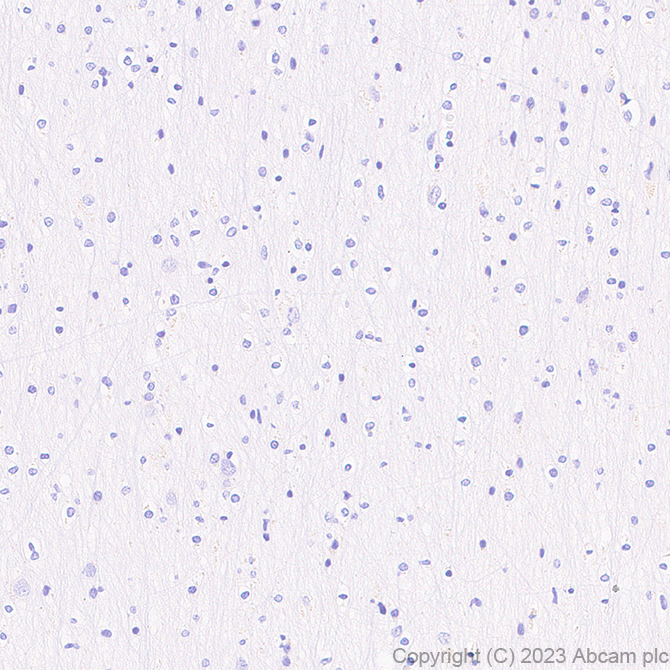 Immunohistochemistry (Formalin/PFA-fixed paraffin-embedded sections) - Anti-Aquaporin 3 antibody [EPR28053-11] (AB307969), expandable thumbnail