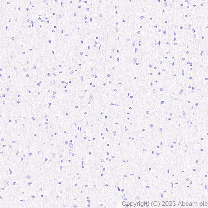 Immunohistochemistry (Formalin/PFA-fixed paraffin-embedded sections) - Anti-Aquaporin 3 antibody [EPR28053-11] (AB307969)