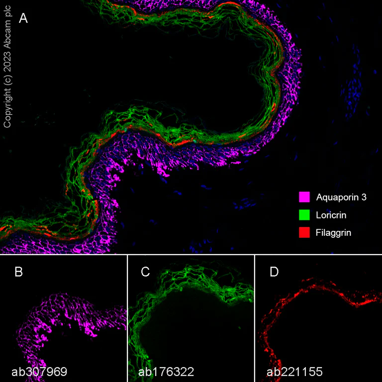 Multiplex immunohistochemistry - Anti-Aquaporin 3 antibody [EPR28053-11] (AB307969)