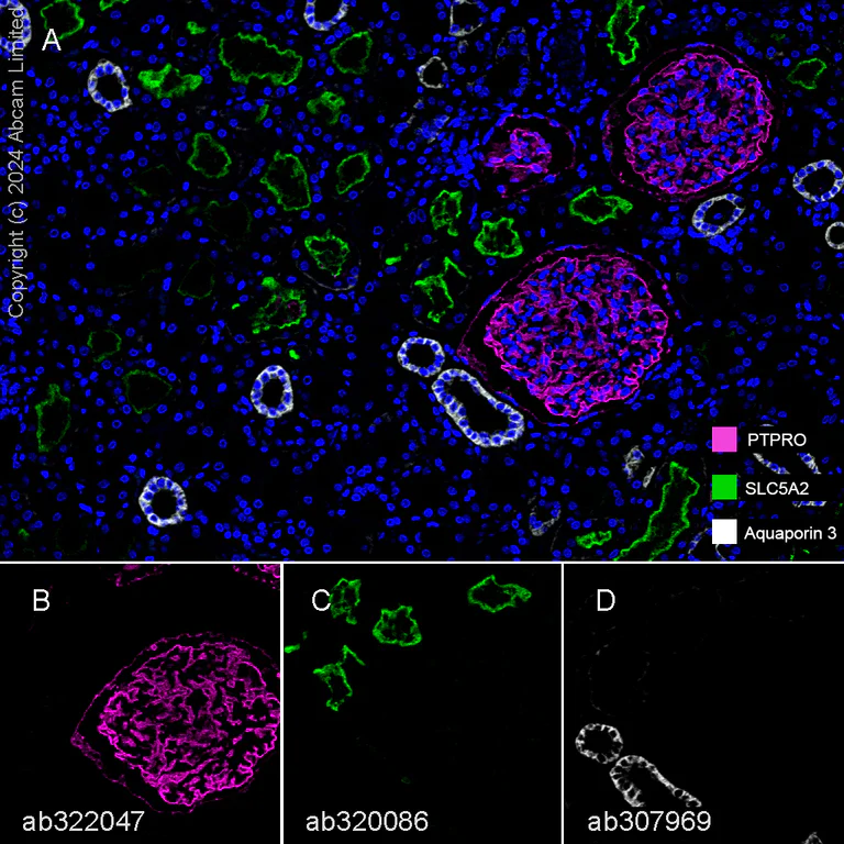 Multiplex immunohistochemistry - Anti-Aquaporin 3 antibody [EPR28053-11] (AB307969)
