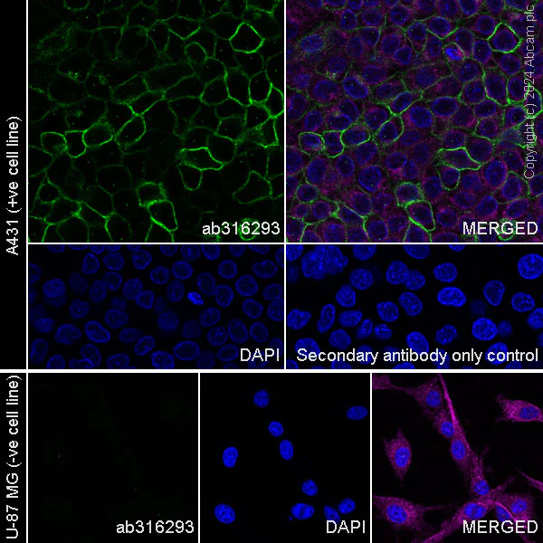 Immunocytochemistry/ Immunofluorescence - Anti-Aquaporin 3 antibody [RM1081] (AB316293)