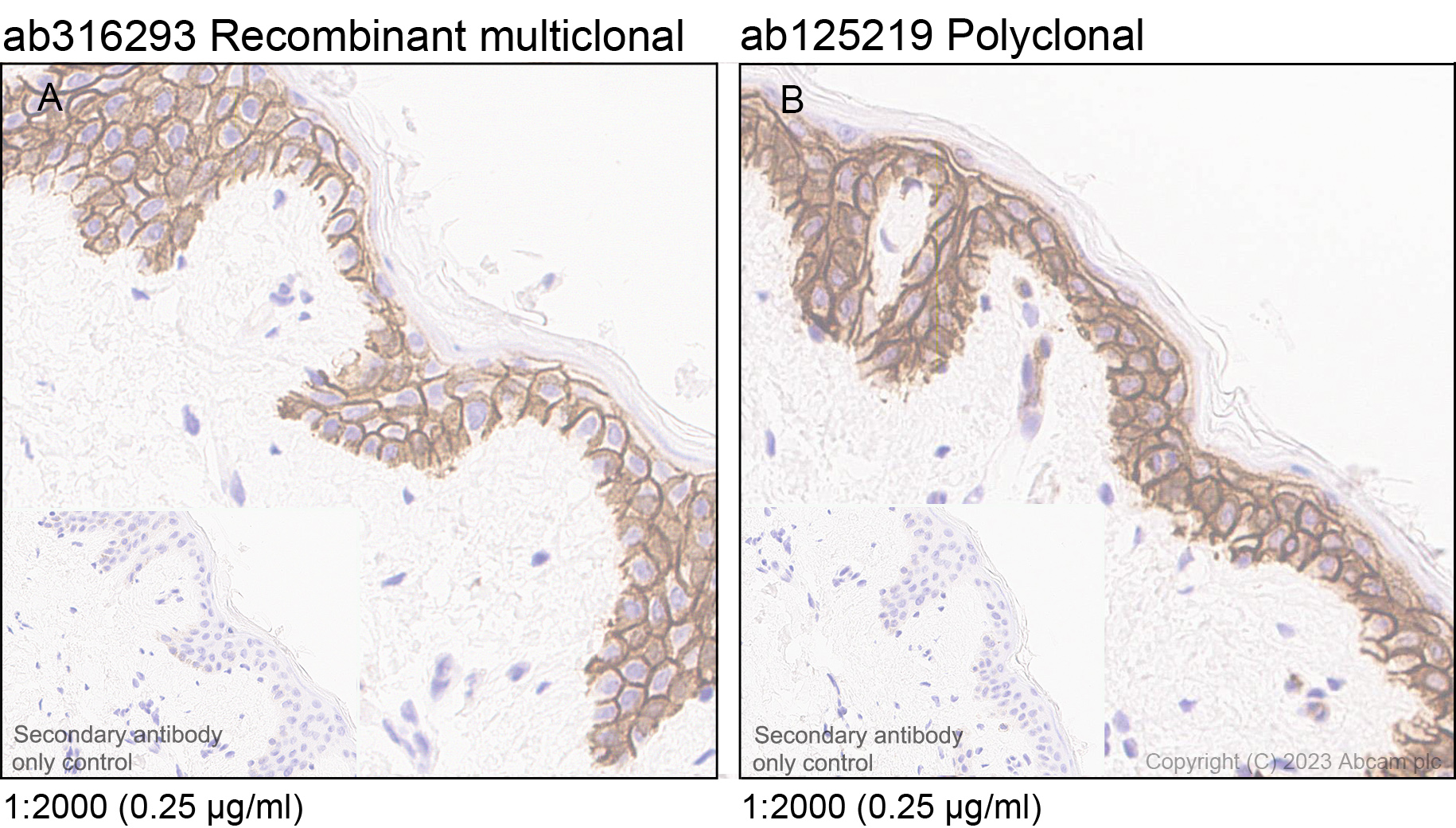 Immunohistochemistry (Formalin/PFA-fixed paraffin-embedded sections) - Anti-Aquaporin 3 antibody [RM1081] - BSA and Azide free (AB316294), expandable thumbnail