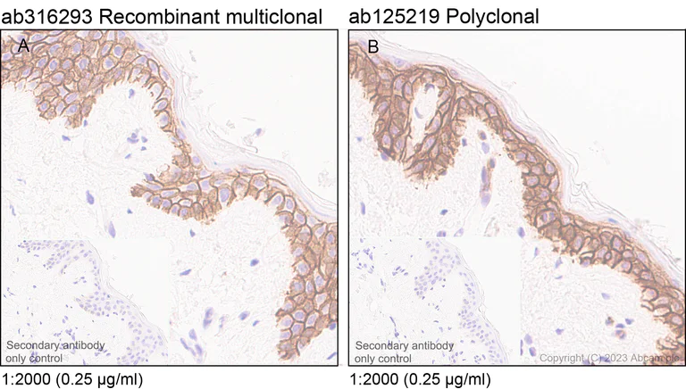 Immunohistochemistry (Formalin/PFA-fixed paraffin-embedded sections) - Anti-Aquaporin 3 antibody [RM1081] - BSA and Azide free (AB316294)