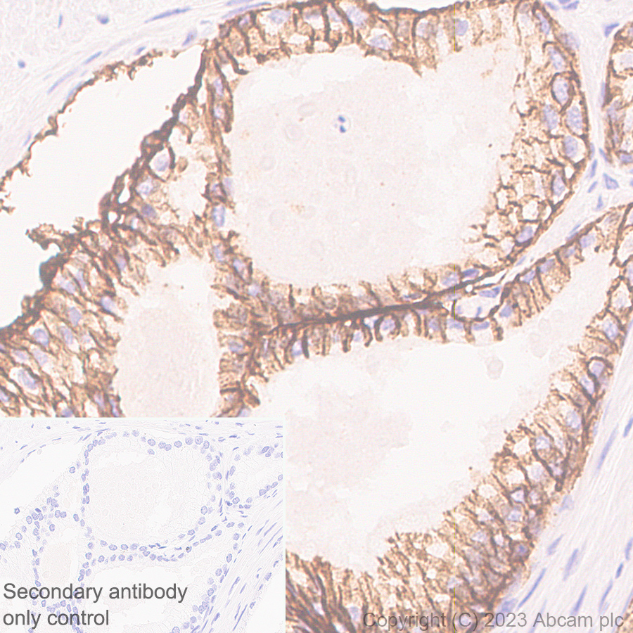 Immunohistochemistry (Formalin/PFA-fixed paraffin-embedded sections) - Anti-Aquaporin 3 antibody [RM1081] - BSA and Azide free (AB316294), expandable thumbnail