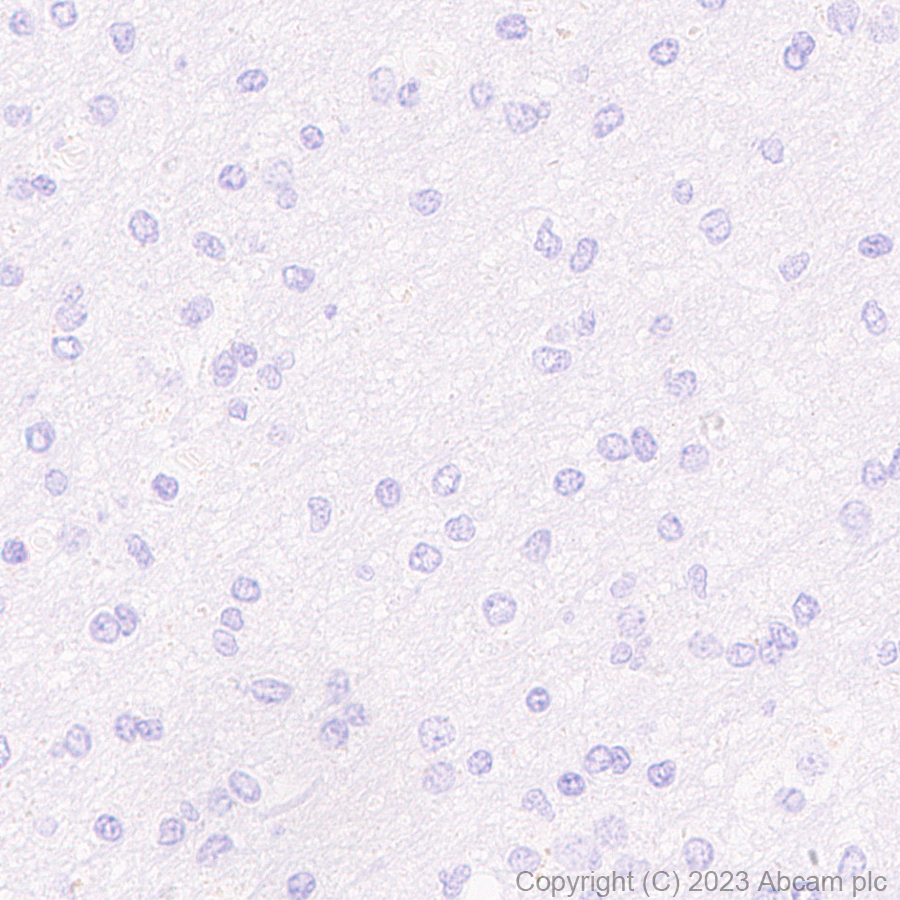 Immunohistochemistry (Formalin/PFA-fixed paraffin-embedded sections) - Anti-Aquaporin 3 antibody [RM1081] - BSA and Azide free (AB316294), expandable thumbnail