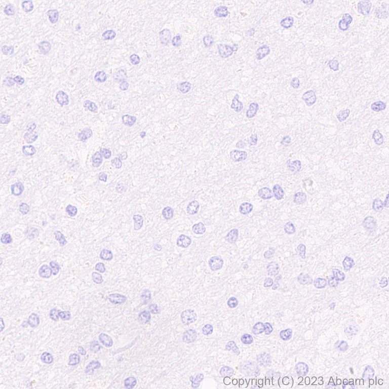 Immunohistochemistry (Formalin/PFA-fixed paraffin-embedded sections) - Anti-Aquaporin 3 antibody [RM1081] - BSA and Azide free (AB316294)