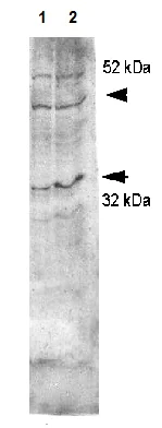 Western blot - Anti-Aquaporin 4 antibody (AB125049)