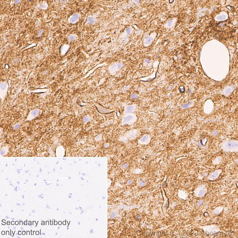 Immunohistochemistry (Formalin/PFA-fixed paraffin-embedded sections) - Anti-Aquaporin 4 antibody [EPR24281-65] (AB259318)