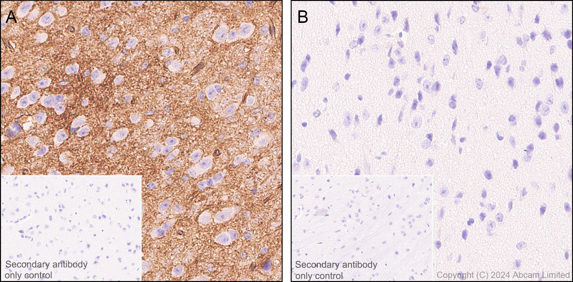 Immunohistochemistry (Formalin/PFA-fixed paraffin-embedded sections) - Anti-Aquaporin 4 antibody [EPR24281-65] (AB259318)