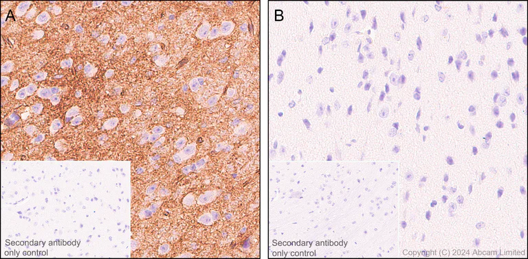 Immunohistochemistry (Formalin/PFA-fixed paraffin-embedded sections) - Anti-Aquaporin 4 antibody [EPR24281-65] (AB259318)