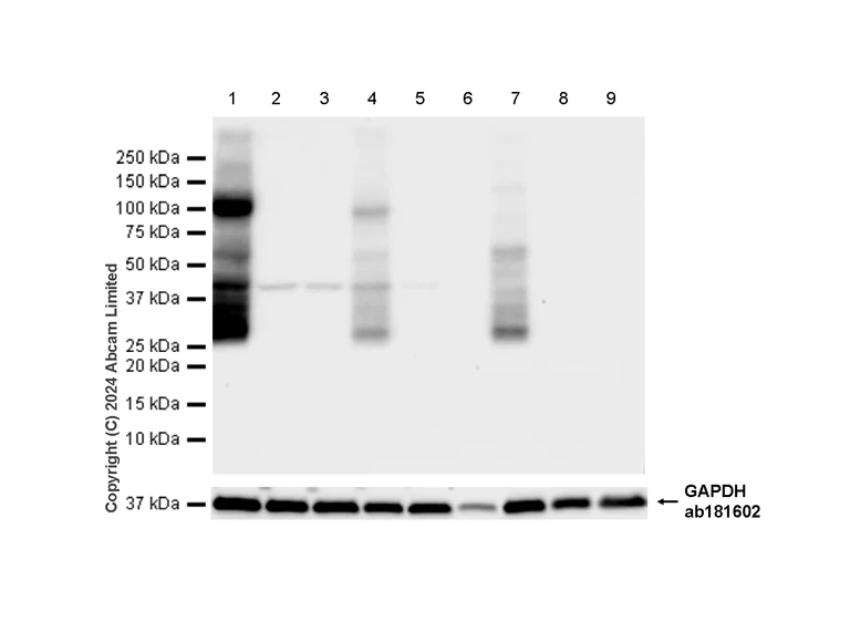 Western blot - Anti-Aquaporin 4 antibody [EPR24281-65] (AB259318)