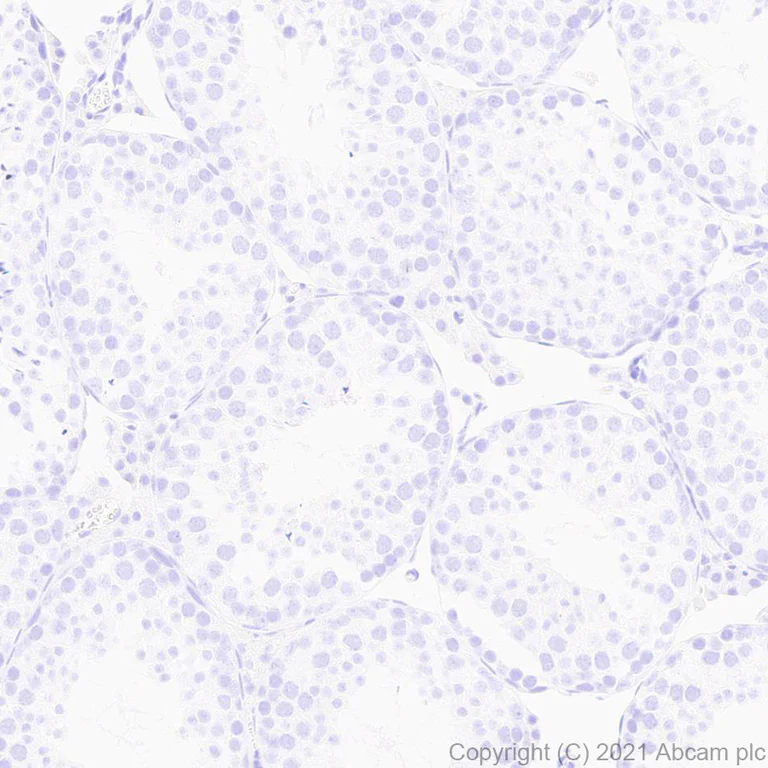 Immunohistochemistry (Formalin/PFA-fixed paraffin-embedded sections) - Anti-Aquaporin 4 antibody [EPR24281-65] - BSA and Azide free (AB282586)