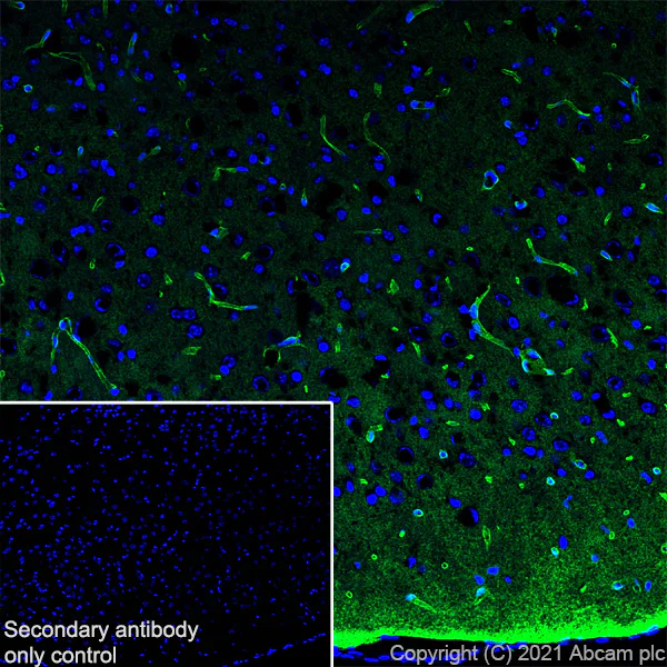 Anti-Aquaporin 4 antibody [EPR24281-65] - Carrier free
