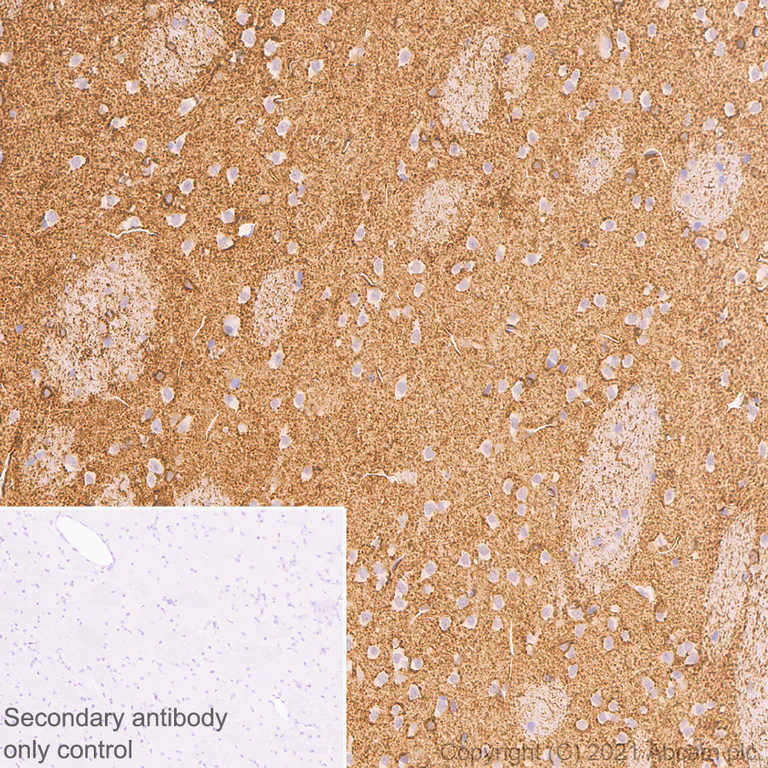 Immunohistochemistry (Formalin/PFA-fixed paraffin-embedded sections) - Anti-Aquaporin 4 antibody [EPR7040] - BSA and Azide free (AB248213)
