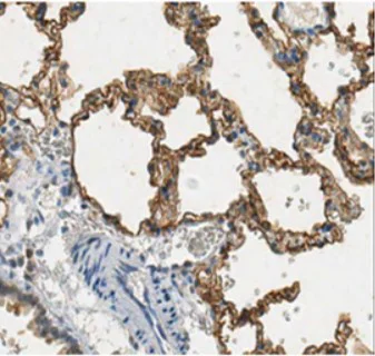 Immunohistochemistry (Formalin/PFA-fixed paraffin-embedded sections) - Anti-Aquaporin 5 antibody (AB78486)