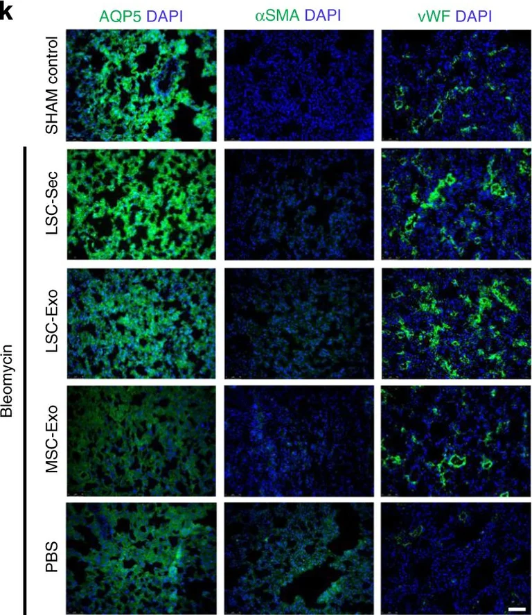 Immunohistochemistry - Anti-Aquaporin 5 antibody (AB78486)