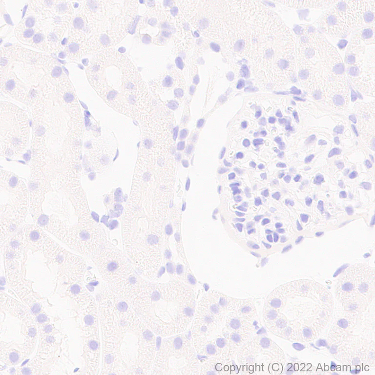 Immunohistochemistry (Formalin/PFA-fixed paraffin-embedded sections) - Anti-Aquaporin 5 antibody [EPR27474-70] (AB305303)