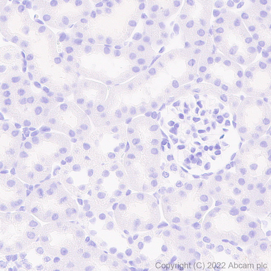 Immunohistochemistry (Formalin/PFA-fixed paraffin-embedded sections) - Anti-Aquaporin 5 antibody [EPR27474-70] - BSA and Azide free (ab305304), expandable thumbnail