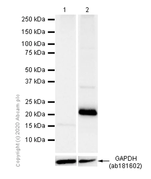 Western blot - Anti-Aquaporin 5 antibody [EPR3747] (AB92320)