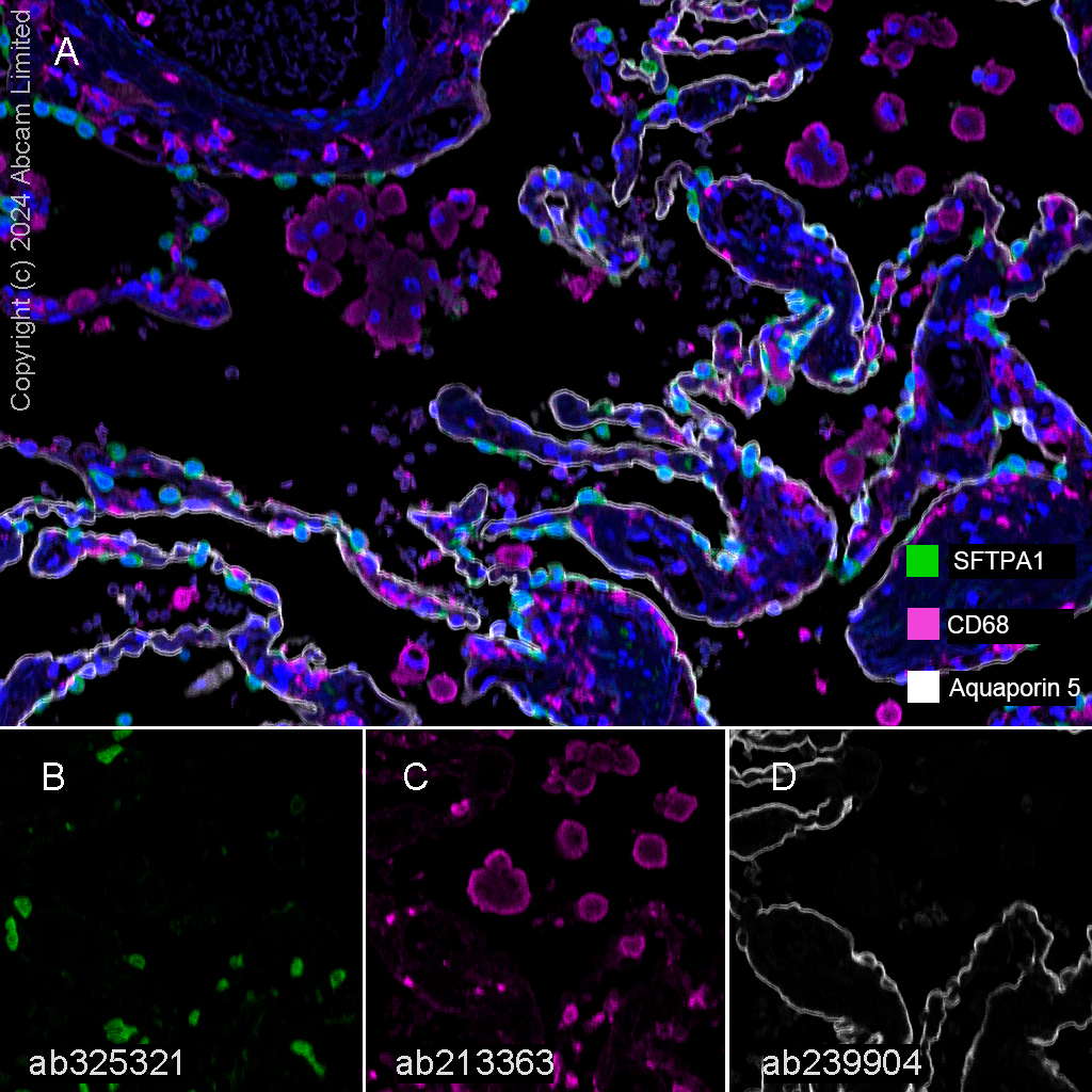 Multiplex immunohistochemistry - Anti-Aquaporin 5 antibody [EPR3747] - BSA and Azide free (AB239904)