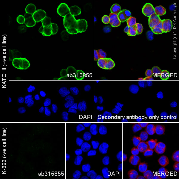 Immunocytochemistry/ Immunofluorescence - Anti-Aquaporin 5 antibody [RM1099] (ab315855), expandable thumbnail