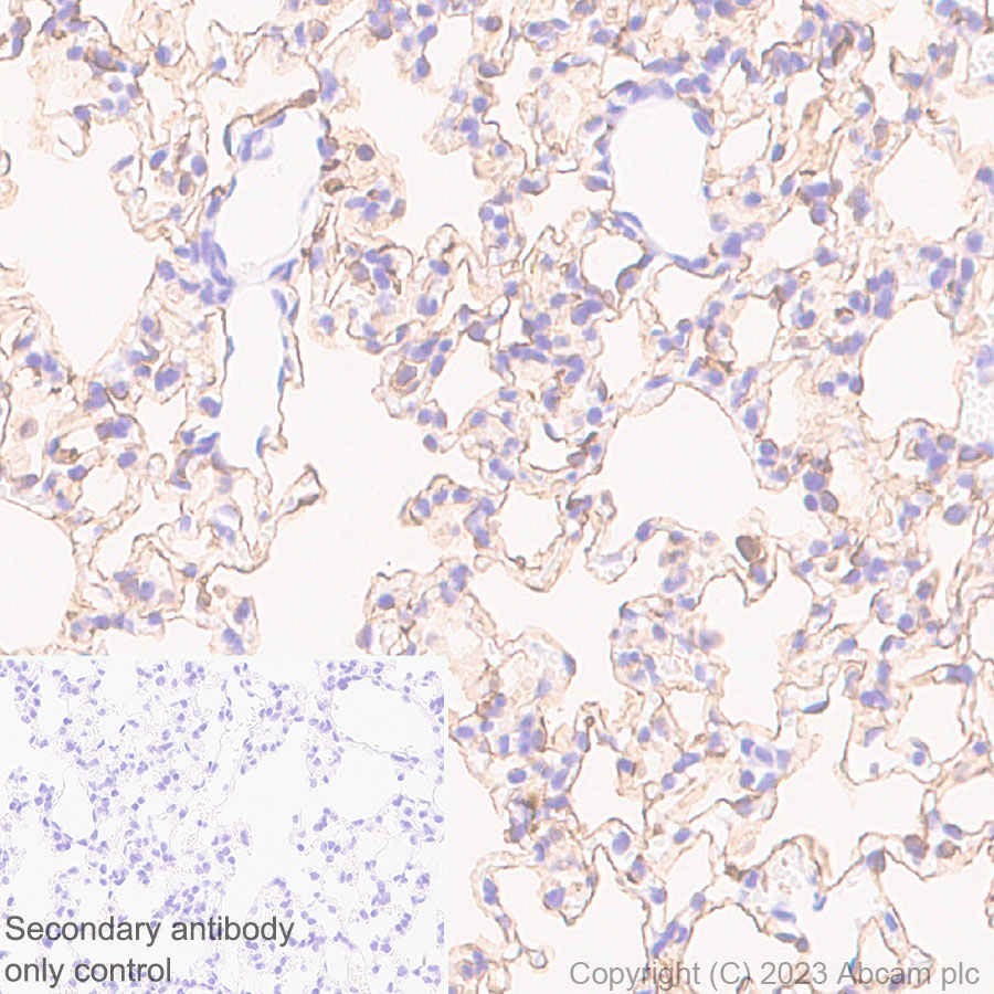 Immunohistochemistry (Formalin/PFA-fixed paraffin-embedded sections) - Anti-Aquaporin 5 antibody [RM1099] (ab315855), expandable thumbnail