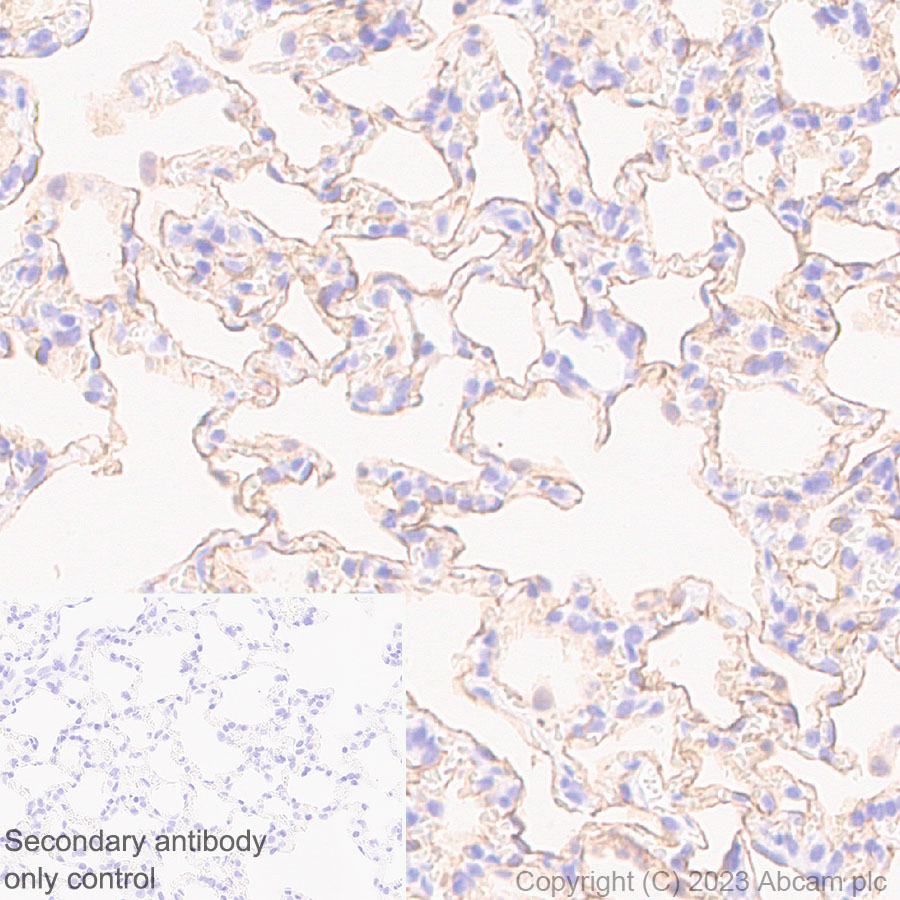 Immunohistochemistry (Formalin/PFA-fixed paraffin-embedded sections) - Anti-Aquaporin 5 antibody [RM1099] (ab315855), expandable thumbnail