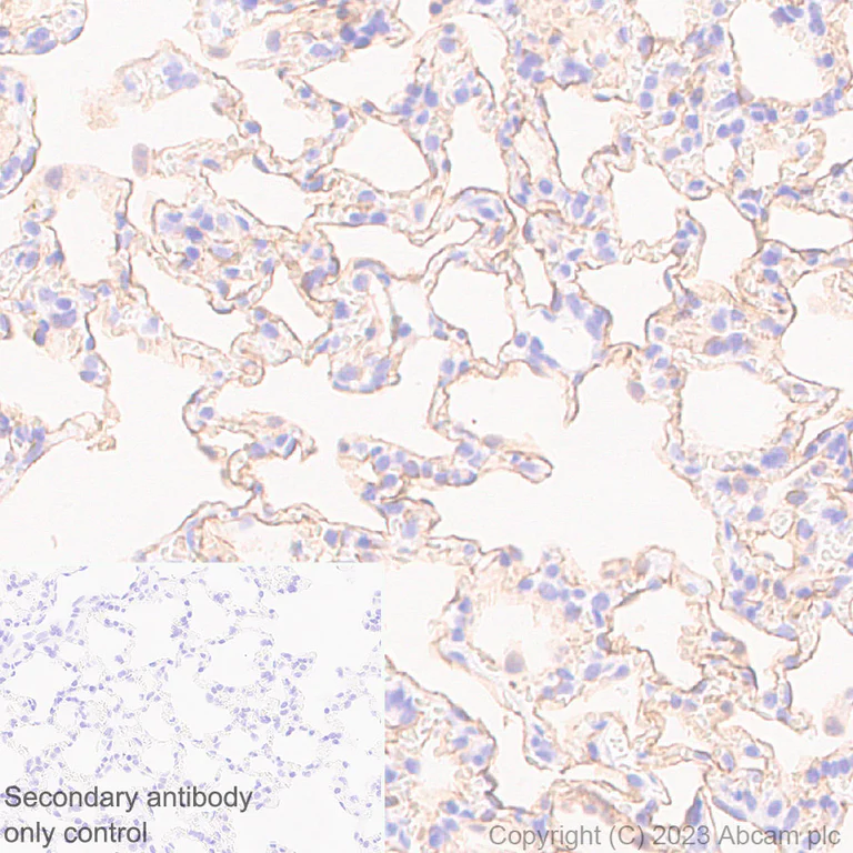 Immunohistochemistry (Formalin/PFA-fixed paraffin-embedded sections) - Anti-Aquaporin 5 antibody [RM1099] (AB315855)