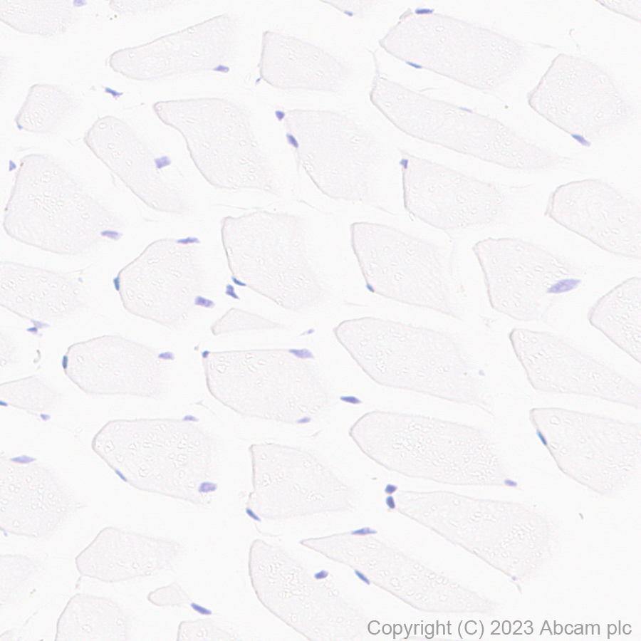Immunohistochemistry (Formalin/PFA-fixed paraffin-embedded sections) - Anti-Aquaporin 5 antibody [RM1099] (ab315855), expandable thumbnail