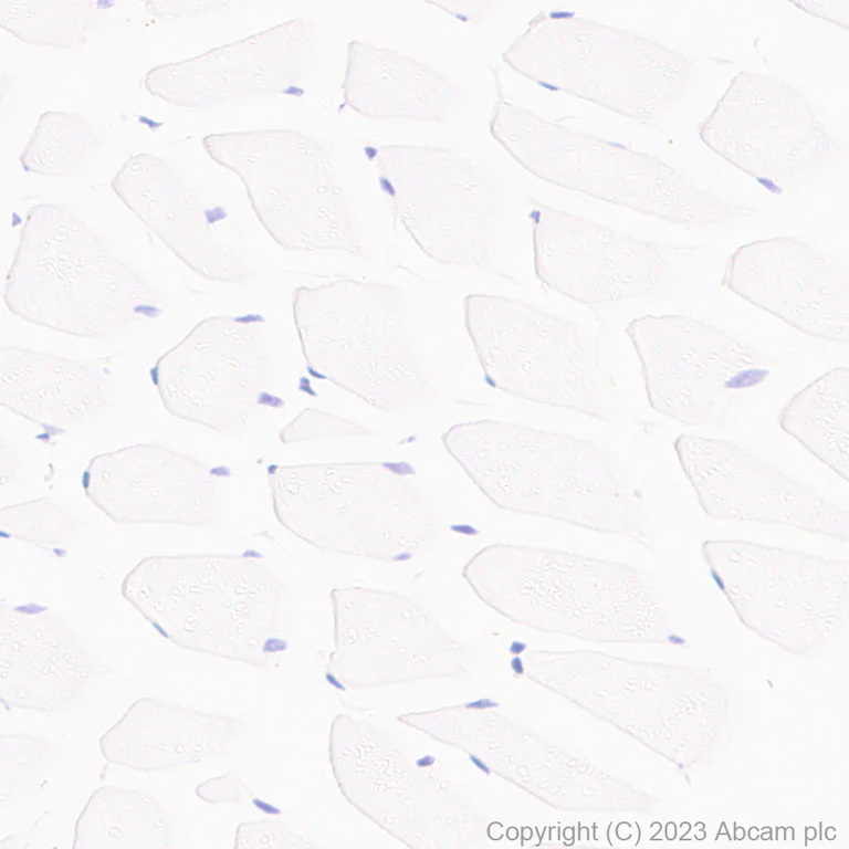 Immunohistochemistry (Formalin/PFA-fixed paraffin-embedded sections) - Anti-Aquaporin 5 antibody [RM1099] (AB315855)