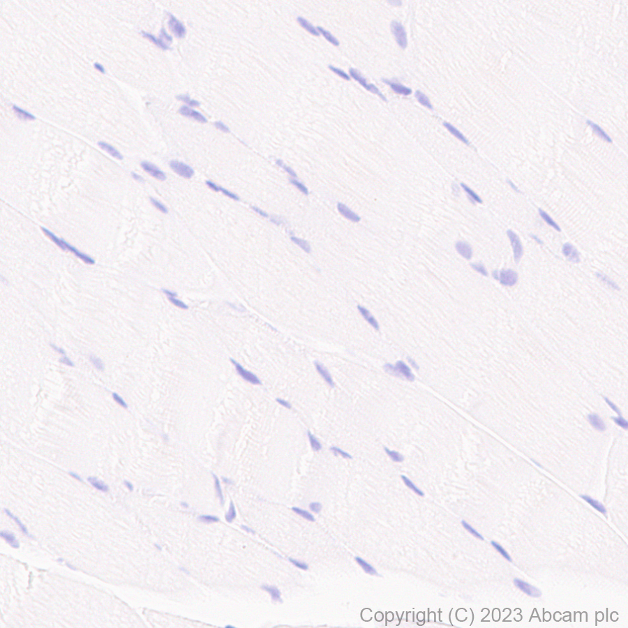 Immunohistochemistry (Formalin/PFA-fixed paraffin-embedded sections) - Anti-Aquaporin 5 antibody [RM1099] (ab315855), expandable thumbnail