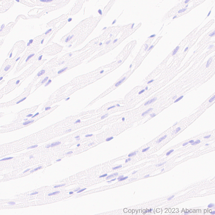 Immunohistochemistry (Formalin/PFA-fixed paraffin-embedded sections) - Anti-Aquaporin 5 antibody [RM1099] (ab315855), expandable thumbnail