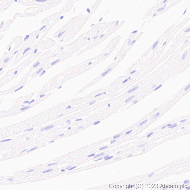 Immunohistochemistry (Formalin/PFA-fixed paraffin-embedded sections) - Anti-Aquaporin 5 antibody [RM1099] (AB315855)