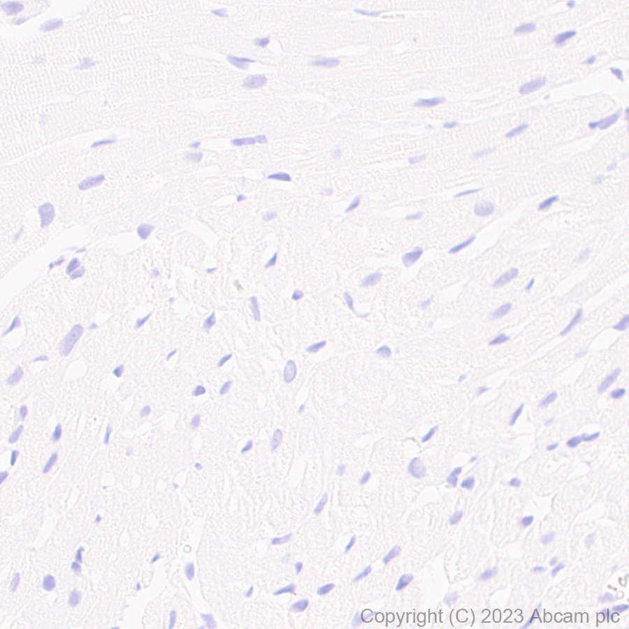 Immunohistochemistry (Formalin/PFA-fixed paraffin-embedded sections) - Anti-Aquaporin 5 antibody [RM1099] (ab315855), expandable thumbnail