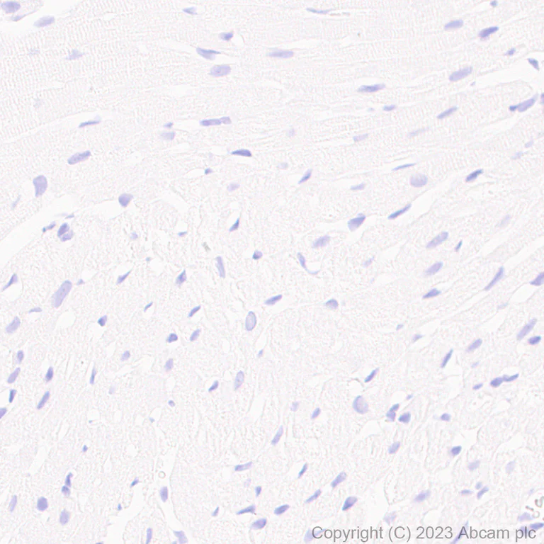 Immunohistochemistry (Formalin/PFA-fixed paraffin-embedded sections) - Anti-Aquaporin 5 antibody [RM1099] (AB315855)