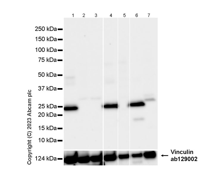 Western blot - Anti-Aquaporin 5 antibody [RM1099] (AB315855), expandable thumbnail