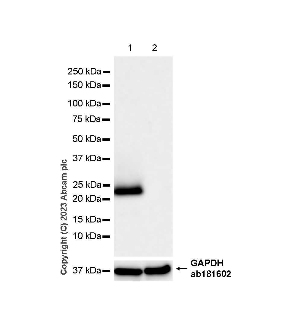 Western blot - Anti-Aquaporin 5 antibody [RM1099] (AB315855), expandable thumbnail