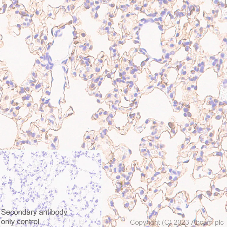 Immunohistochemistry (Formalin/PFA-fixed paraffin-embedded sections) - Anti-Aquaporin 5 antibody [RM1099] - BSA and Azide free (AB315856)