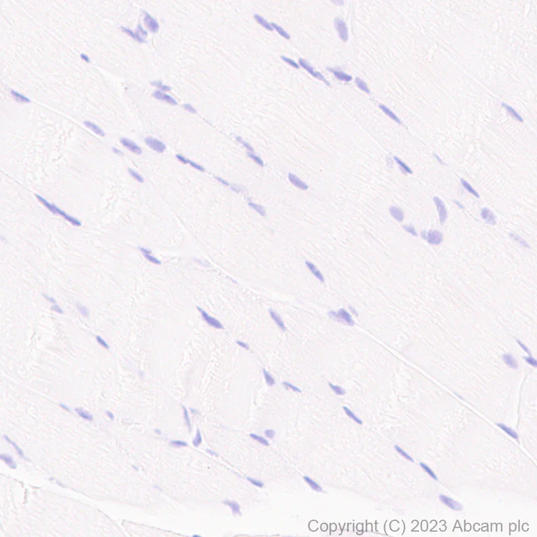 Immunohistochemistry (Formalin/PFA-fixed paraffin-embedded sections) - Anti-Aquaporin 5 antibody [RM1099] - BSA and Azide free (AB315856)