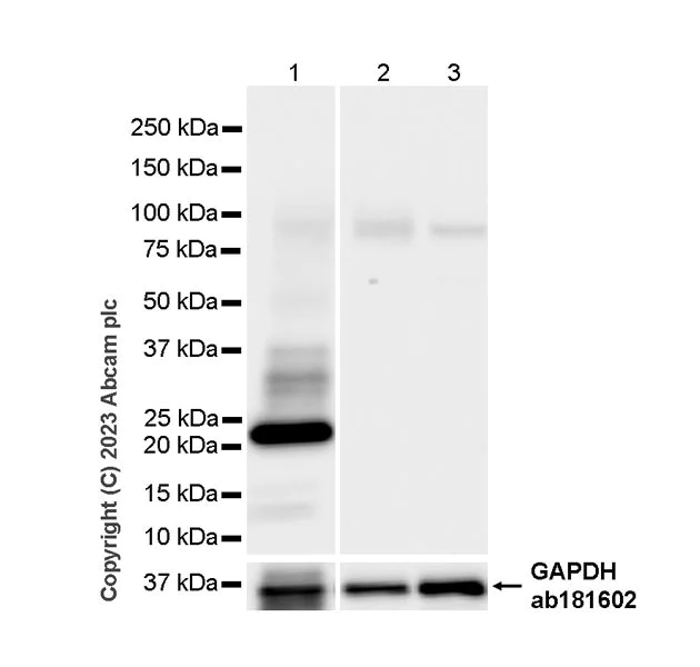 Western blot - Anti-Aquaporin 5 antibody [RM1099] - BSA and Azide free (AB315856)