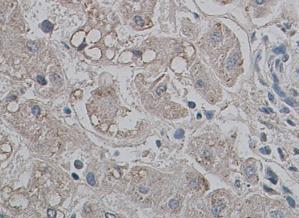 Immunohistochemistry (Formalin/PFA-fixed paraffin-embedded sections) - Anti-Aquaporin 9/AQP-9 antibody (AB84828)