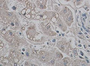Immunohistochemistry (Formalin/PFA-fixed paraffin-embedded sections) - Anti-Aquaporin 9/AQP-9 antibody (AB84828)
