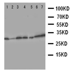 Western blot - Anti-Aquaporin 9/AQP-9 antibody - C-terminal (AB191056), expandable thumbnail