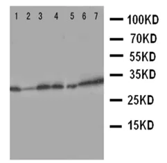 Western blot - Anti-Aquaporin 9/AQP-9 antibody - C-terminal (AB191056)
