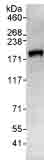 Immunoprecipitation - Anti-ARAP1 antibody (AB99382), expandable thumbnail